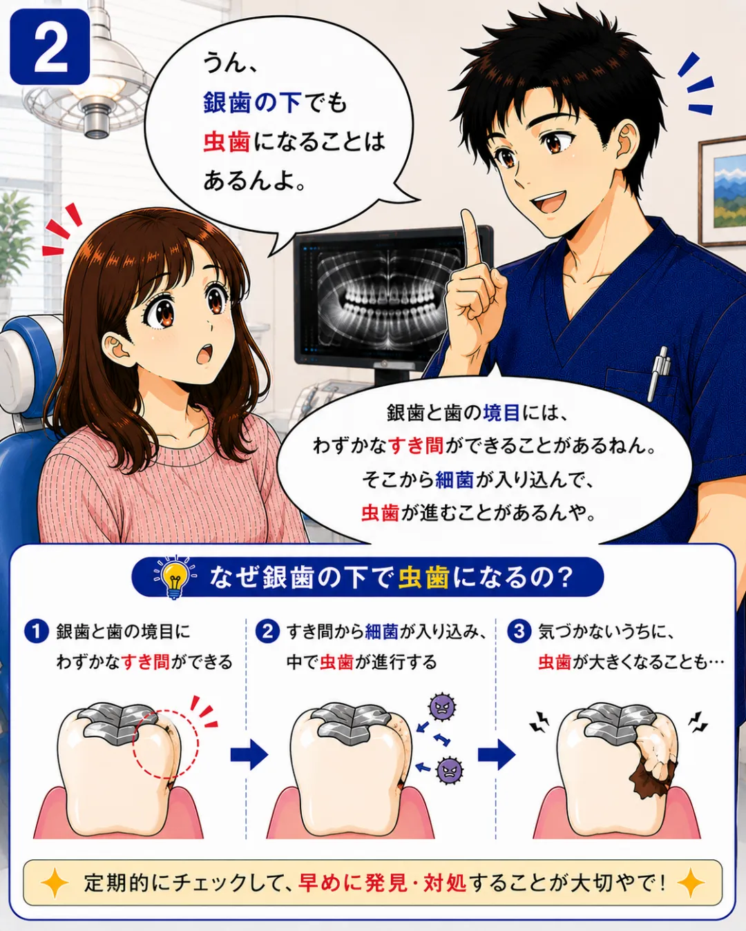銀歯や詰め物と歯の境目から細菌が入り込み詰め物の下に二次虫歯ができることがあります