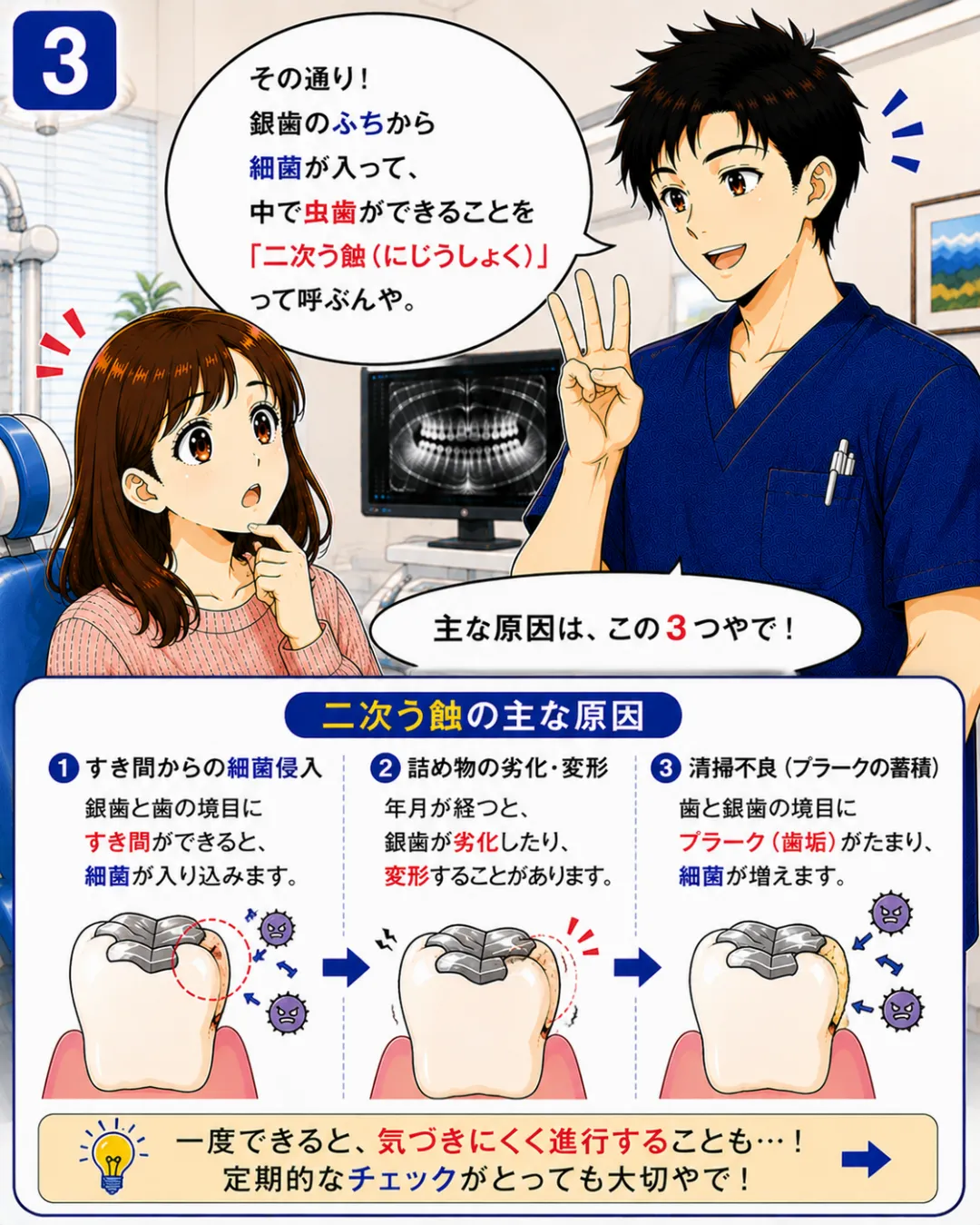 銀歯の下にできた二次虫歯は外から見えにくく気づかないうちに進行することがあります