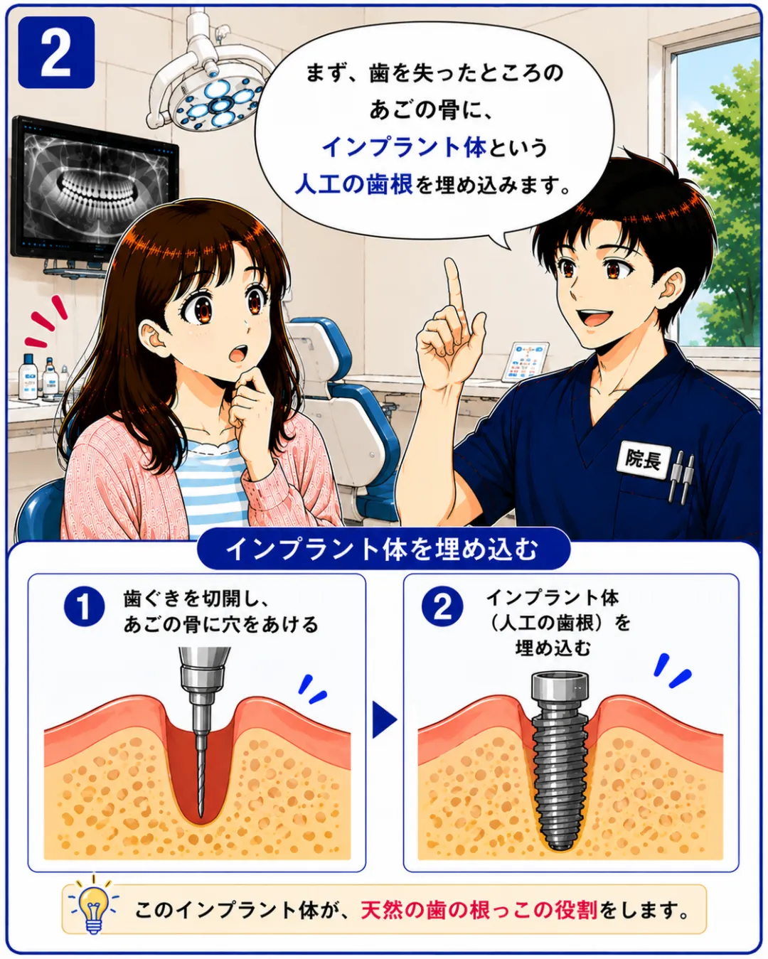 インプラント治療では失った歯の部分に人工歯根を埋め込みその上に人工の歯を装着します