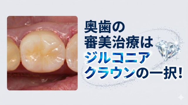 二度と虫歯にならないゴールドインレー | びわ湖大津デンタル