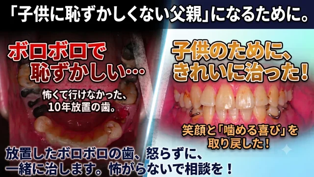 二度と虫歯にならないゴールドインレー | びわ湖大津デンタル