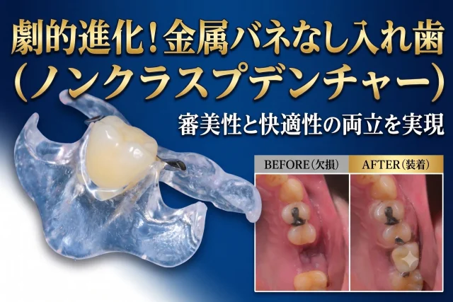 二度と虫歯にならないゴールドインレー | びわ湖大津デンタル